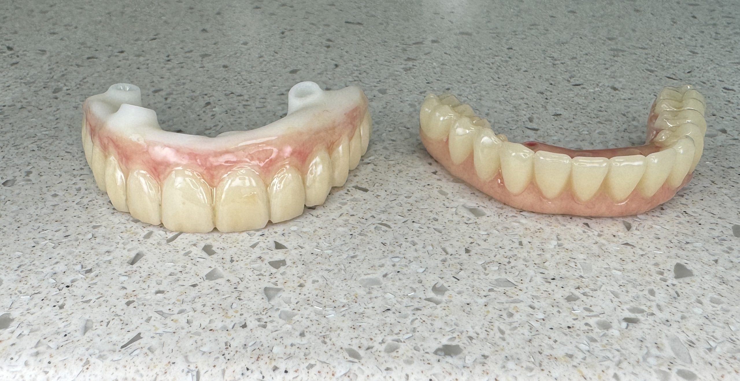 dental crowns in san antonio