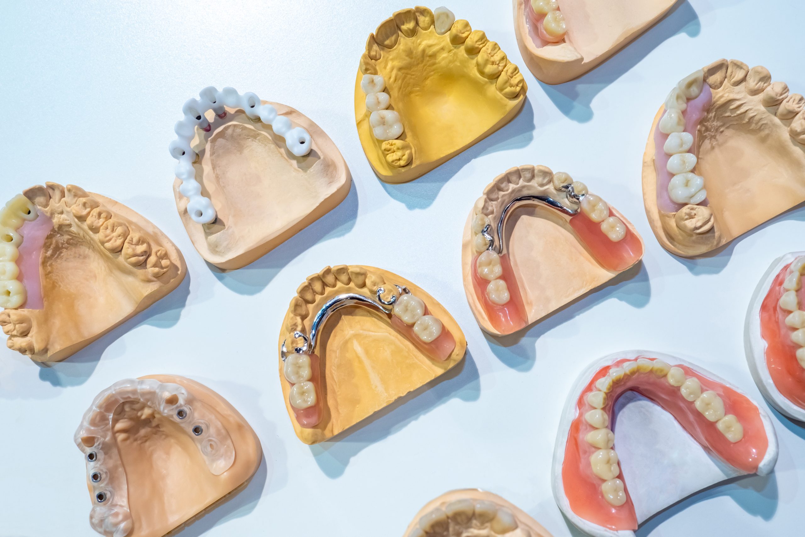 types of dentures